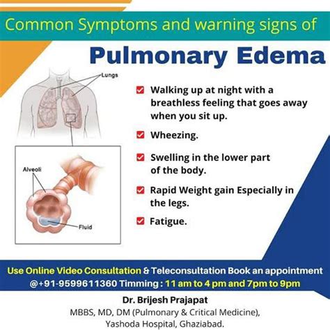 Pulmonary Edema Symptoms: List of Signs of .